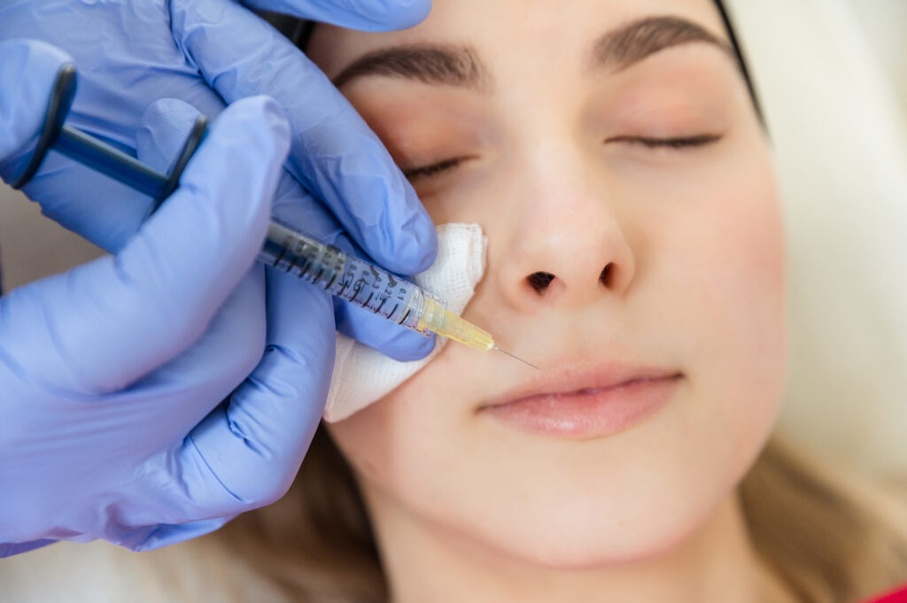 Lippenunterspritzung